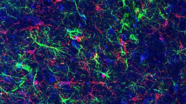 Immune cells in the brain - microglia - may be activated by bacteria in the gut