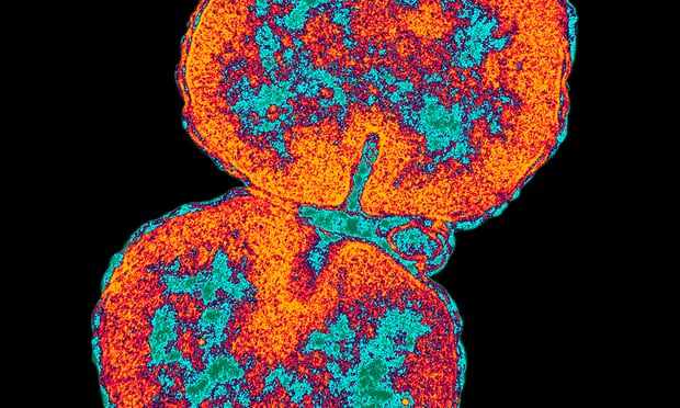  The WHO estimates 78 million people a year get gonorrhoea, an STD that can infect the genitals, rectum and throat. Photograph: Dr. David M. Phillips/Getty Images/Visuals Unlimited