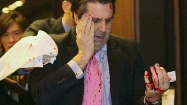 US Ambassador Mark Lippert was slashed across the face