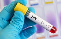 HIV findings in DR Congo 'give hope for cure'